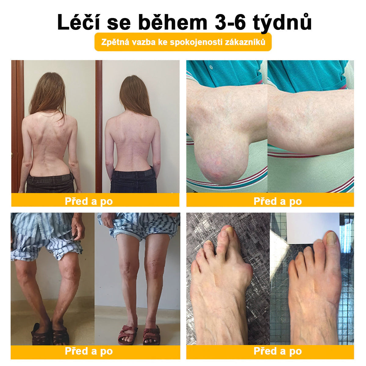 🦵𝐁𝐒𝐖𝐄𝐋𝐋® Včela Jed Proti Bolesti Hojení Kostí Krém👨‍⚕️𝐀𝐀𝐎𝐒 doporučuje (specializuje se na ortopedická onemocnění a bolesti)