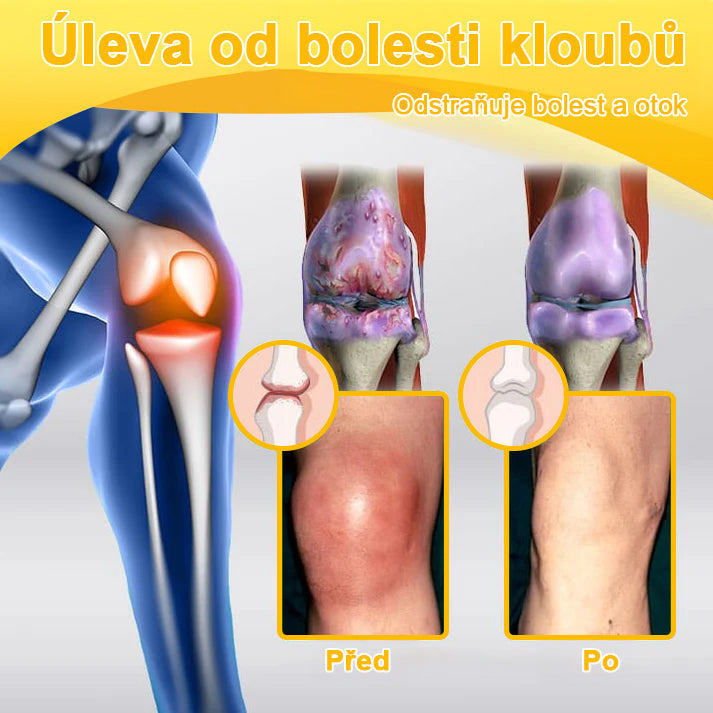 🦵𝐁𝐒𝐖𝐄𝐋𝐋® Včela Jed Proti Bolesti Hojení Kostí Krém👨‍⚕️𝐀𝐀𝐎𝐒 doporučuje (specializuje se na ortopedická onemocnění a bolesti)