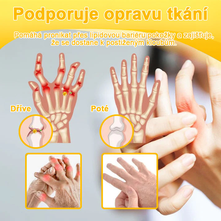 🦵𝐁𝐒𝐖𝐄𝐋𝐋® Včela Jed Proti Bolesti Hojení Kostí Krém👨‍⚕️𝐀𝐀𝐎𝐒 doporučuje (specializuje se na ortopedická onemocnění a bolesti)